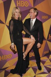 Nadia Comaneci – HBO’s Official Golden Globe Awards 2018 After Party