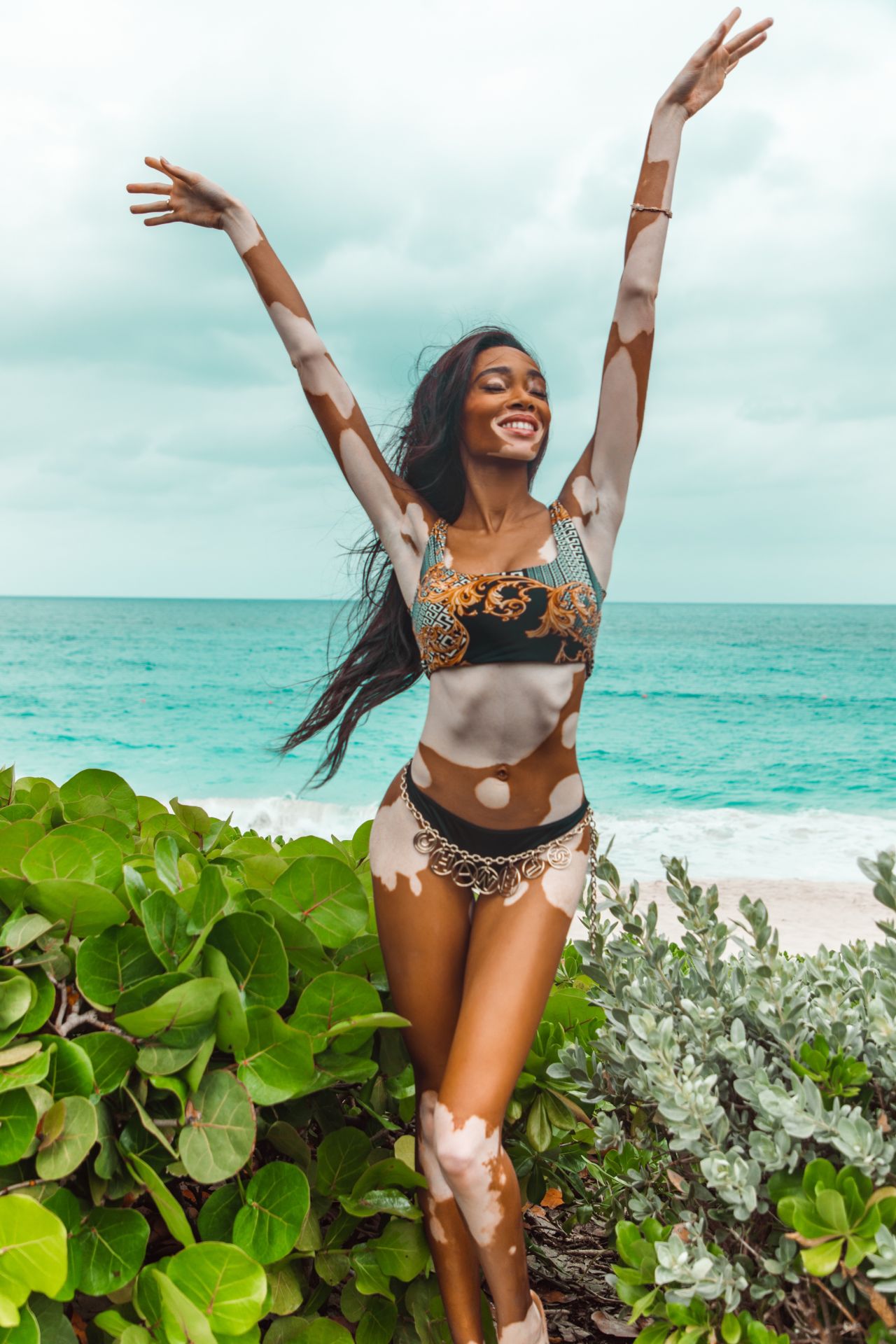 Winnie Harlow In Bikini V Magazine Photos • Celebmafia