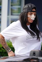 Katie Price After Nose, Lifted Lips and Abdominal Etching Surgery 07/09/2023
